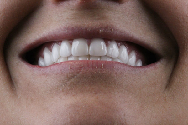 WhatsApp mulher dentes Dr Alysson Resende
