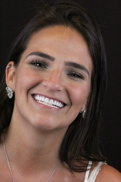 WhatsApp mulher dentes e boca Dr Alysson Resende