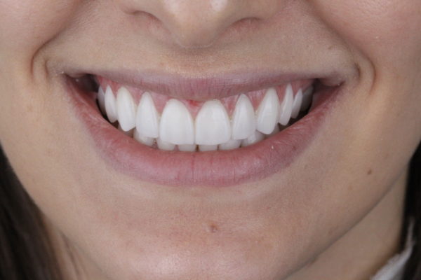 WhatsApp dentes e boca Dr Alysson Resende