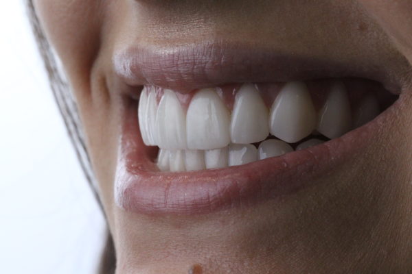 WhatsApp dentes perfeitos Dr Alysson Resende