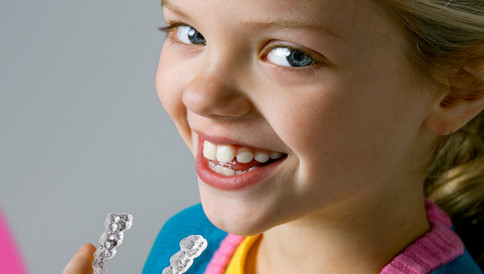 Teste Kids invisalign by Doctor Alysson Resende - Ortodontista e Dentista em BH