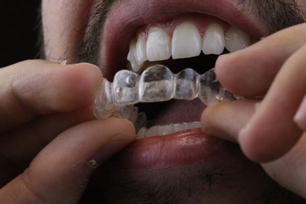 WhatsApp homem de barba invisalign Dr Alysson Resende