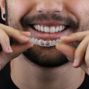 WhatsApp homem invisalign odontologia Dr Alysson Resende