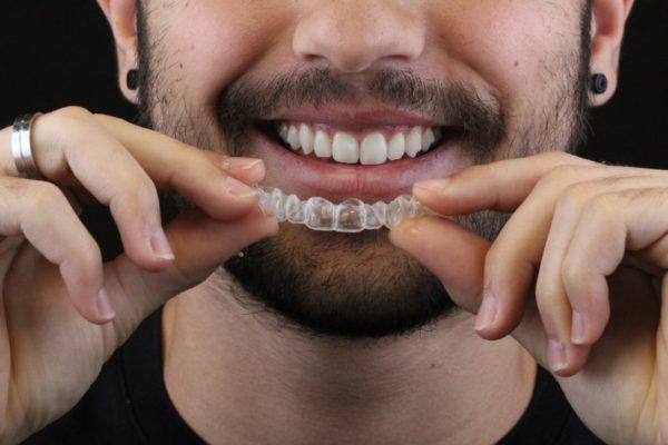 WhatsApp homem invisalign odontologia Dr Alysson Resende