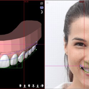 Digital Smile Design - DSD