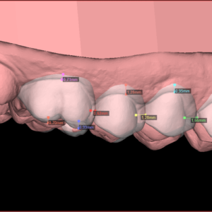 Digital Smile Design - DSD