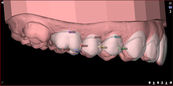 Digital Smile Design - DSD