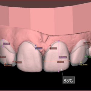 Digital Smile Design - DSD