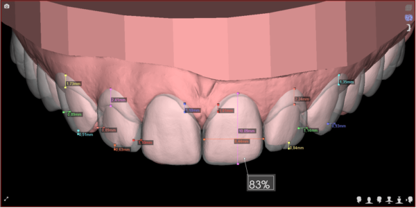 Digital Smile Design - DSD