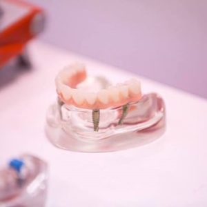 A Nobel Biocare é a mais nova parceira da AR Odontologia