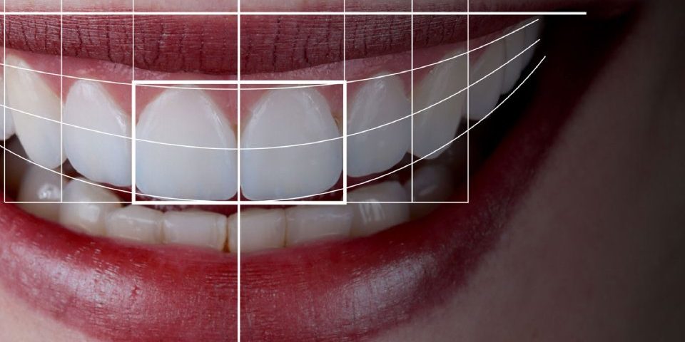 Sorriso hi-tech, técnica Digital Smile Design - DSD