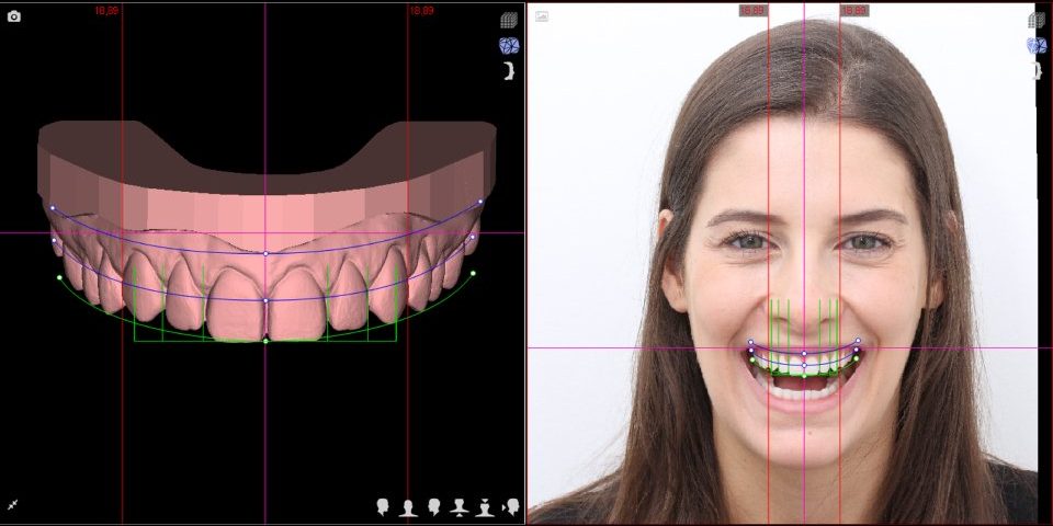 Digital Smile Design, seu sorriso confiante