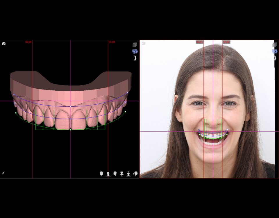 Digital Smile Design, seu sorriso confiante