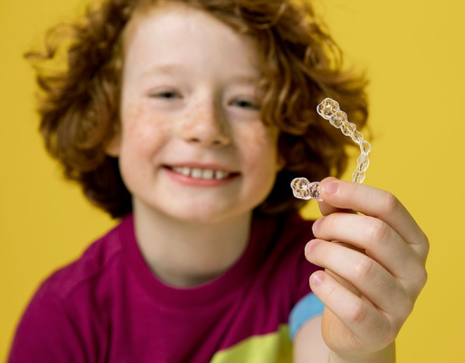 Chegou a vez do seu baixinho tecnologia Invisalign